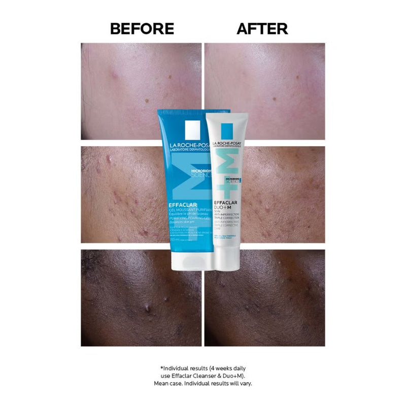 La Roche-Posay Effaclar Duo+M Anti-Blemish Corrective Gel Moisturiser for Oily, Blemish-Prone Skin 40ml