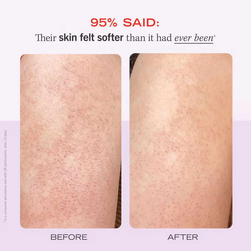 First Aid Beauty KP Bump Eraser Fresh Strawberry Body Scrub with 10% AHA 56.7g
