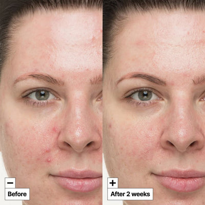 Dr.Jart+ Dermask Pore Remedy Purifying Mud Mask 24g