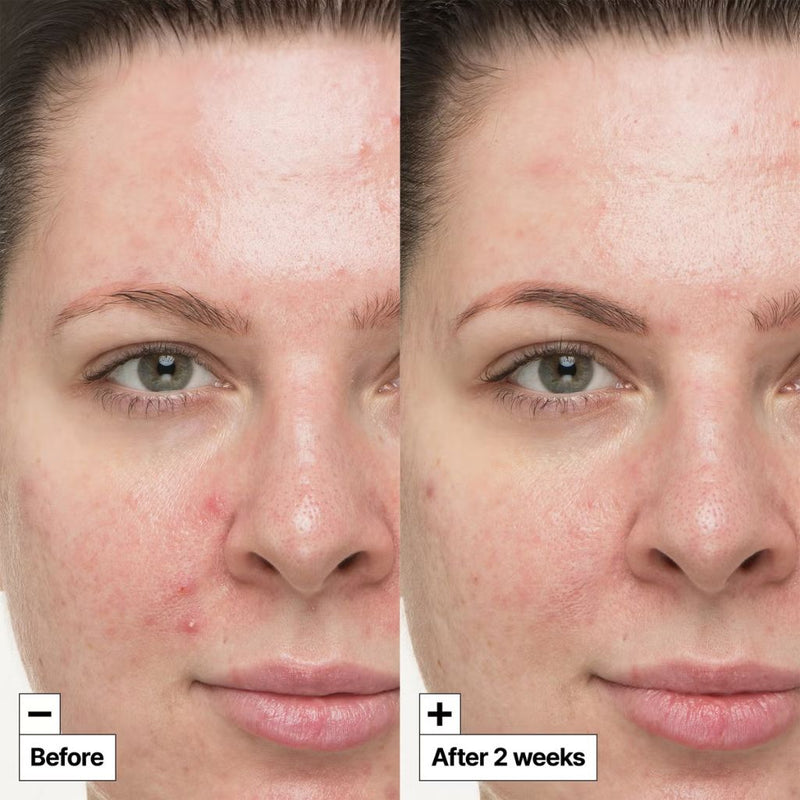 Dr.Jart+ Dermask Pore Remedy Purifying Mud Mask 24g