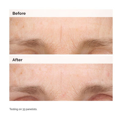 The Ordinary Retinal 0.2% Emulsion 15ml