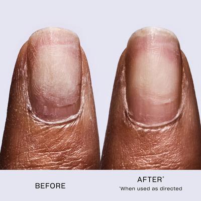OPI Repair Mode™ Bond Building Nail Treatment Serum 9ml