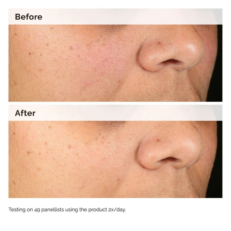 The Ordinary Alpha Arbutin 2% + HA 60ml