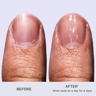 OPI Treatment Power Duo - 2 x 15ml (Worth £41.6)