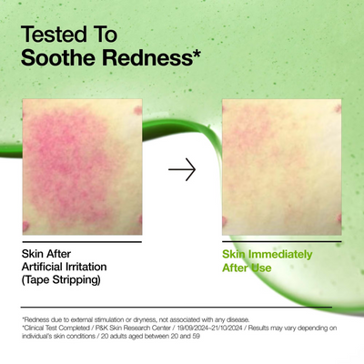 Anua Azelaic Acid 10 Hyaluron Redness Soothing Serum 30ml
