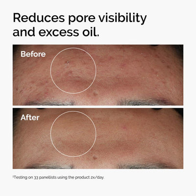 The Ordinary Niacinamide 10% + Zinc 1% Serum 30ml