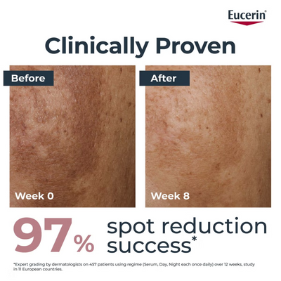 Eucerin Anti-Pigment Dual Face Serum for Pigmentation and Dark Spots 30ml