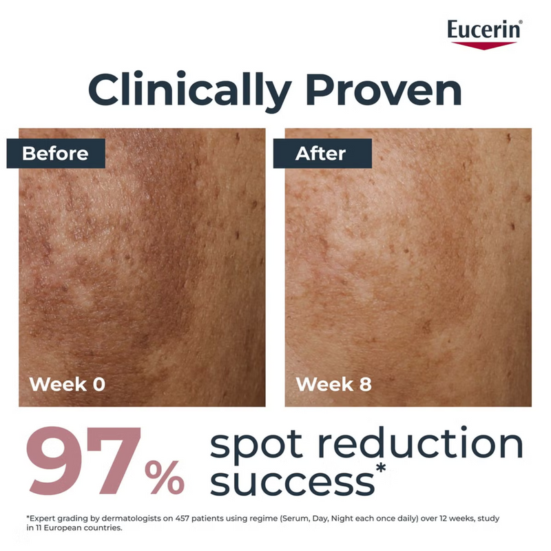 Eucerin Anti-Pigment Dual Face Serum for Pigmentation and Dark Spots 30ml