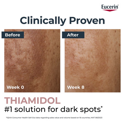 Eucerin Anti-Pigment Skin Perfecting Serum 30ml