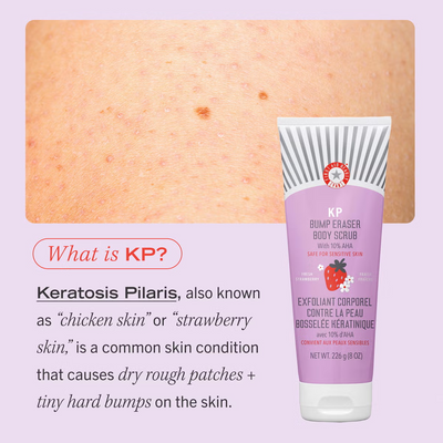 First Aid Beauty KP Bump Eraser Fresh Strawberry Body Scrub with 10% AHA 56.7g