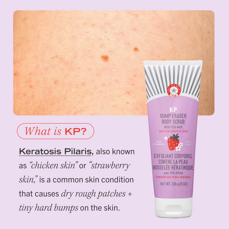 First Aid Beauty KP Bump Eraser Fresh Strawberry Body Scrub with 10% AHA 56.7g