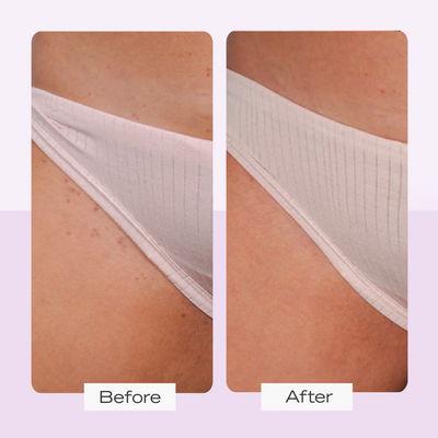 First Aid Beauty Ingrown Hair Treatment Pads (28 Pads)