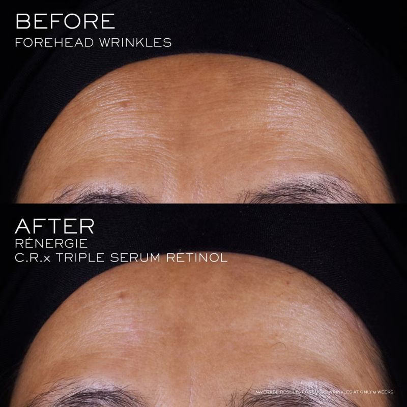 Lancôme Rénergie C.R.x. Triple Serum Retinol (Various Sizes)