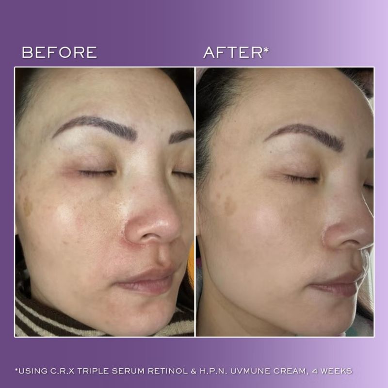 Lancôme Rénergie C.R.x. Triple Serum Retinol (Various Sizes)