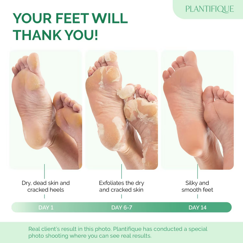 PeachySoft Exfoliating Foot Peel - Repair & Renew 2-Pack