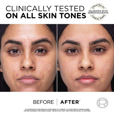 L'Oréal Paris Revitalift Vitamin C Brightening Set with Serum and SPF50 Fluid