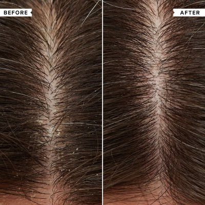 Philip Kingsley Flaky Itchy Shampoo and Conditioner 1000ml Duo