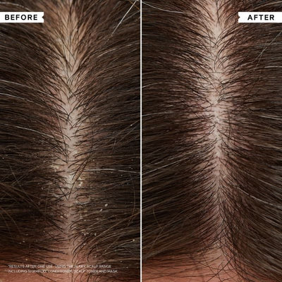 Philip Kingsley Flaky/Itchy Scalp Hydrating Curl Anti-Dandruff Shampoo 75ml