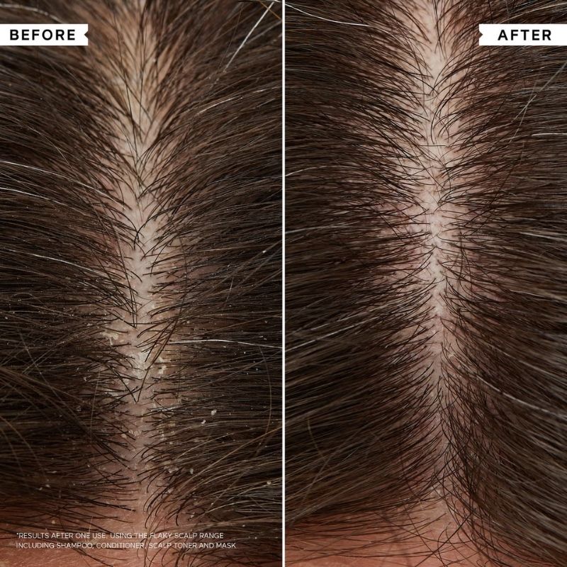 Philip Kingsley Flaky/Itchy Scalp Hydrating Curl Anti-Dandruff Shampoo 75ml