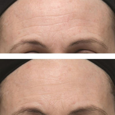 Dr Dennis Gross Vitamin C and Lactic Firm and Bright Eye Treatment 15ml
