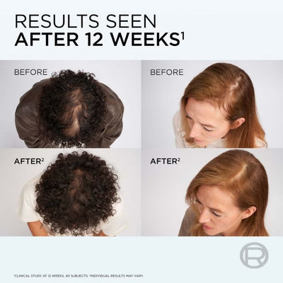 L'Oréal Paris Elvive Growth Booster, Anti-Fall and Hair Thickening, Full Routine Bundle