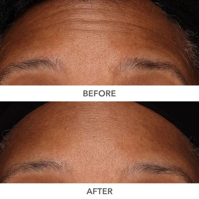 Dr Dennis Gross Skincare DermInfusions Plump, Fill and Repair Kit