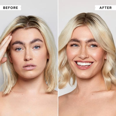 Philip Kingsley Flaky/Itchy Scalp Anti-Dandruff Scalp Toner 250ml