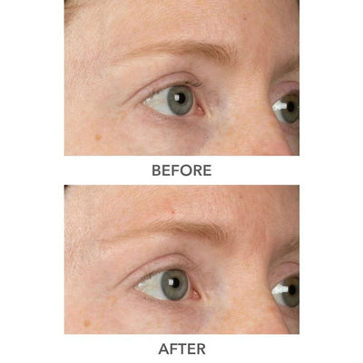 Dr Dennis Gross Skincare DermInfusions Plump, Fill and Repair Kit