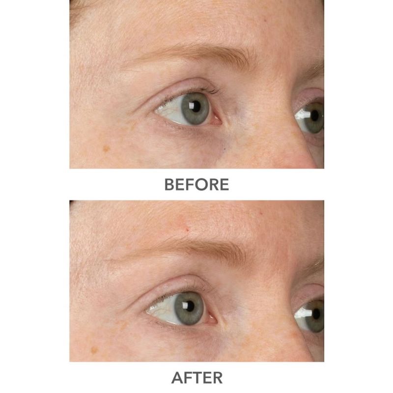 Dr Dennis Gross Skincare DermInfusions Plump, Fill and Repair Kit