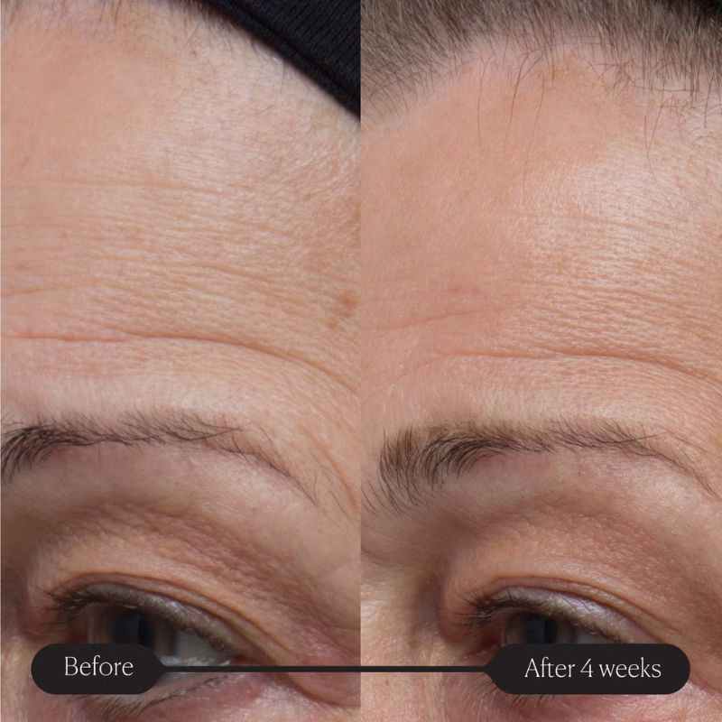Elemis Pro-Collagen Future Restore Serum 30ml