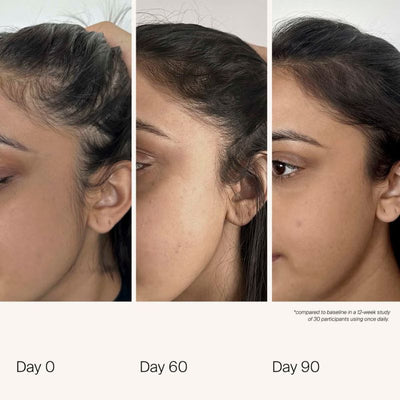 Living Proof Scalp Care Density Serum 50ml