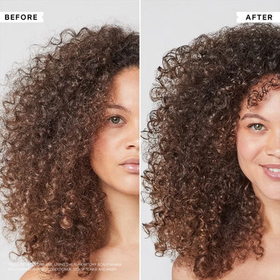 Philip Kingsley Flaky/Itchy Scalp Hydrating Curl Anti-Dandruff Shampoo 250ml