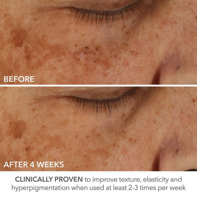 Dr Dennis Gross Skincare Advanced Retinol + Ferulic Perfectly Dosed Retinol Universal 0.2%