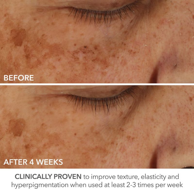 Dr Dennis Gross Skincare Advanced Retinol + Ferulic Perfectly Dosed Retinol Universal 0.2%