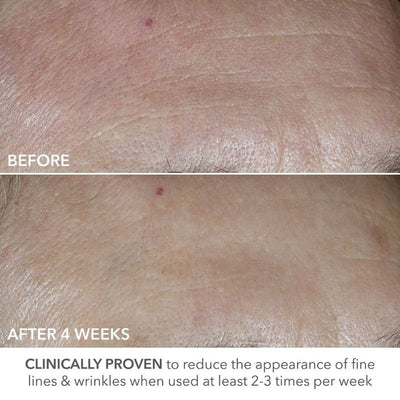 Dr Dennis Gross Skincare Advanced Retinol + Ferulic Perfectly Dosed Retinol Universal 0.2%