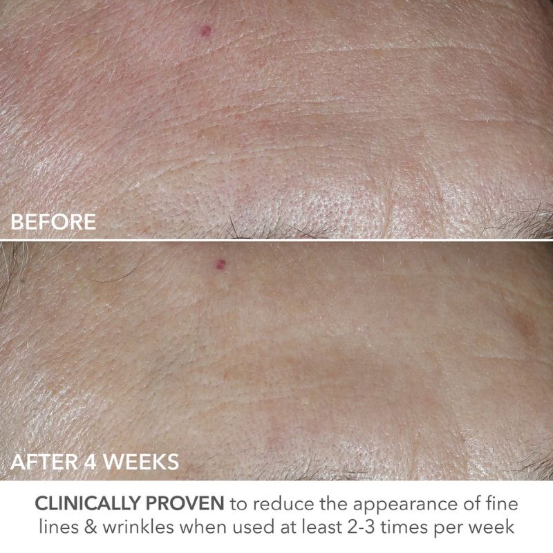 Dr Dennis Gross Skincare Advanced Retinol + Ferulic Perfectly Dosed Retinol Universal 0.2%