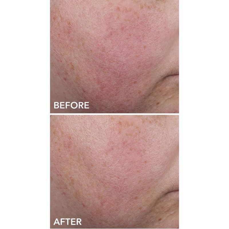 Dr Dennis Gross Skincare DermInfusions Blur and Repair Cream 50ml